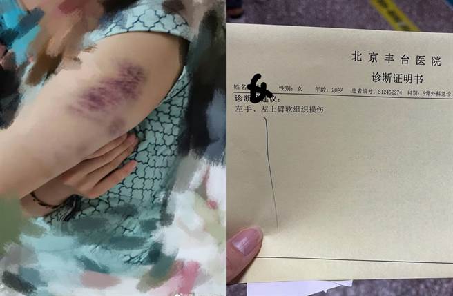 张九南前妻晒出被殴打证据。（图／翻摄自巧克力芋圆奶微博）