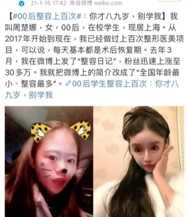 娜娜自曝5年整形百次，還要小孩子別學她。（圖／取自微博）