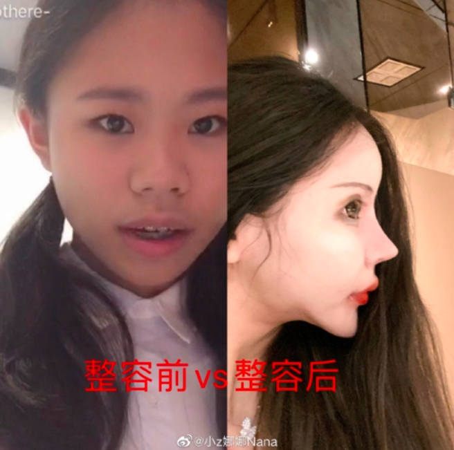 娜娜的今昔對照，原本的樣子被評價其實不差。（圖／取自微博）