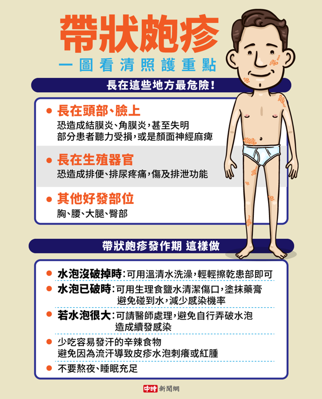 带状疱疹。(图/中时新闻网陈友龄制图)
