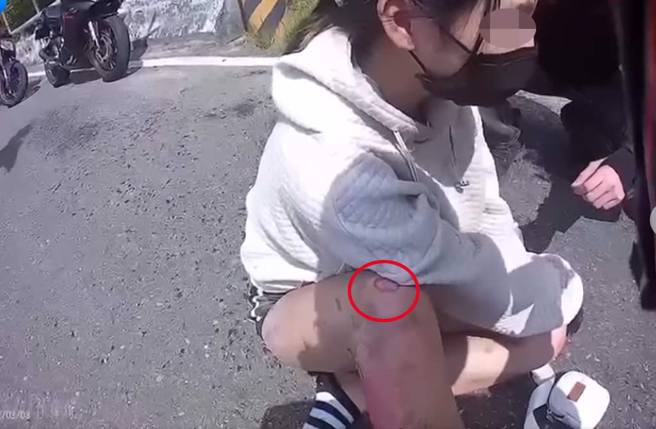 一名年轻女穿短裤骑重机跑山摔车，满腿擦挫伤。（截自脸书《●【爆废公社】●》影片）