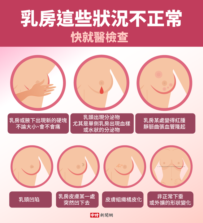 乳房异状恐是乳癌，务必就医确认。(示意图/Shutterstock)