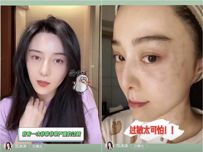 范冰冰日前自曝，自己嚴重過敏。（圖／取材自小紅書）
