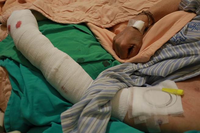 医师在病人神经丛精准放置导管，麻药注入更能发挥止痛效果。（台中慈济医院提供／陈淑娥台中传真）