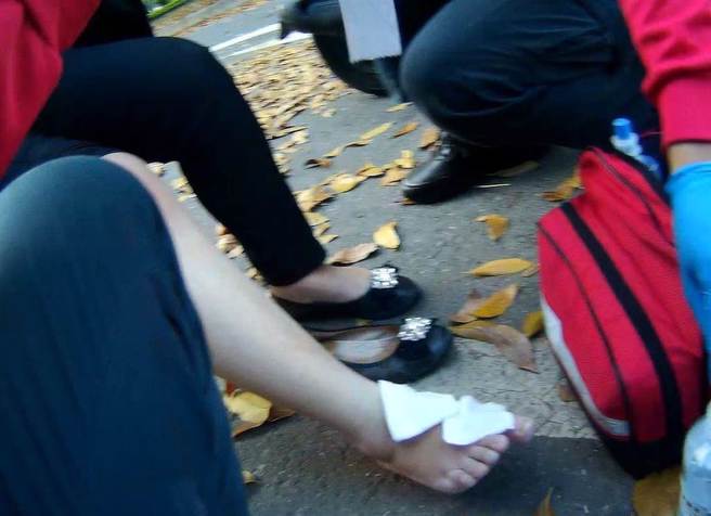 婦人騎機車急煞車，疑因路面落葉打滑而摔倒受傷。（讀者提供）
