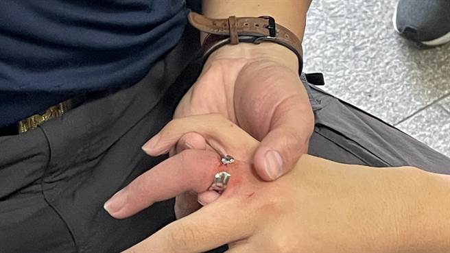 鋼戒的硬度在莫氏硬度8以上，大約是黃金的10倍，移除過程有相當難處。（金門縣消防局提供）