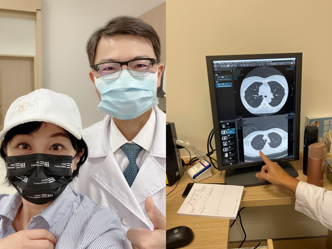 吴淡如今日健检，肺部白点还好没有长大。（图／FB@吴淡如）