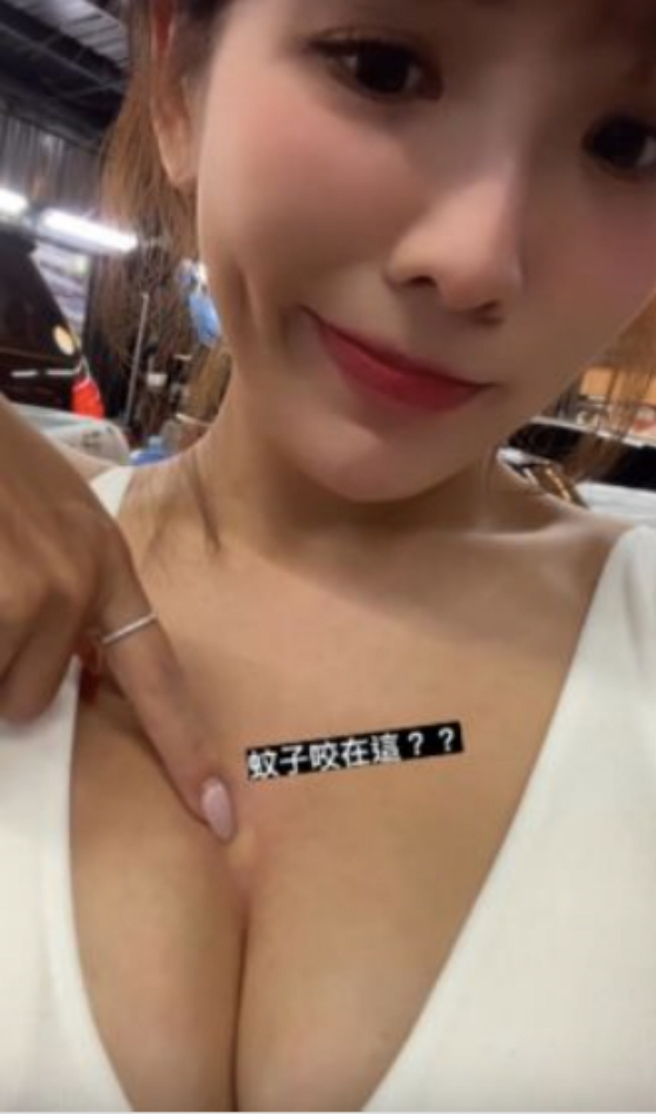 壮壮抱怨被蚊子叮，照片却让网友重点全放错。(图/ 摘自壮壮IG)