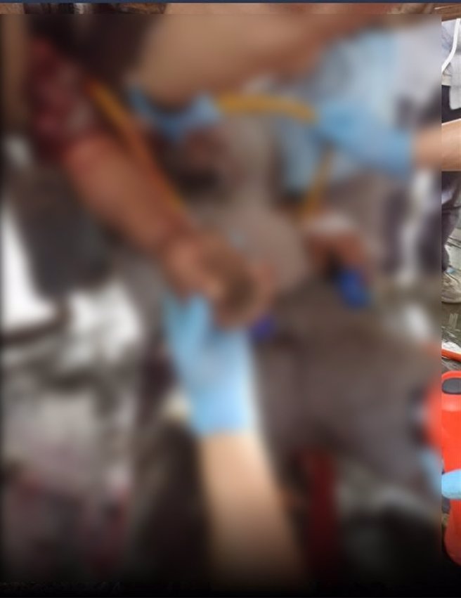 台南環保局外包員工右手捲入機器，右手臂開放性骨折送醫治療。(讀者提供／劉秀芬台南傳真)