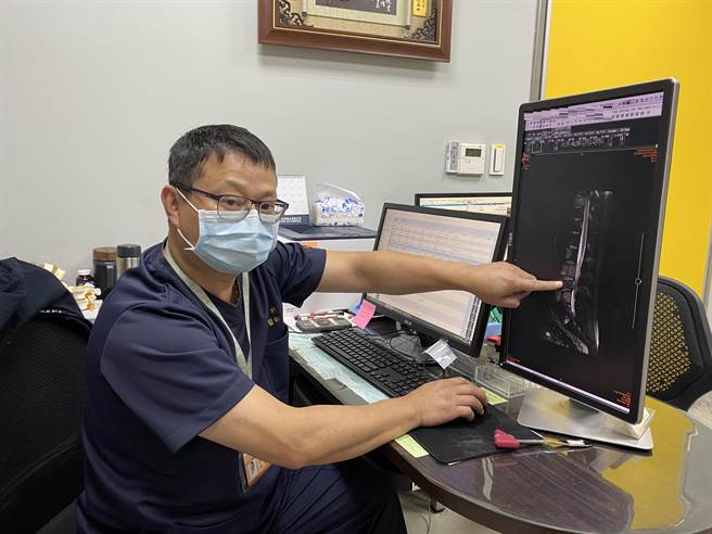 長安醫院副院長、神經外科醫師李漢忠提醒，出現莫名其妙腰痛，特別是越晚越痛、躺在床上翻身就會痛，要特別小心，若合併出現腳麻、無力的現象，應該要立刻就醫。（長安醫院提供／馮惠宜台中傳真）