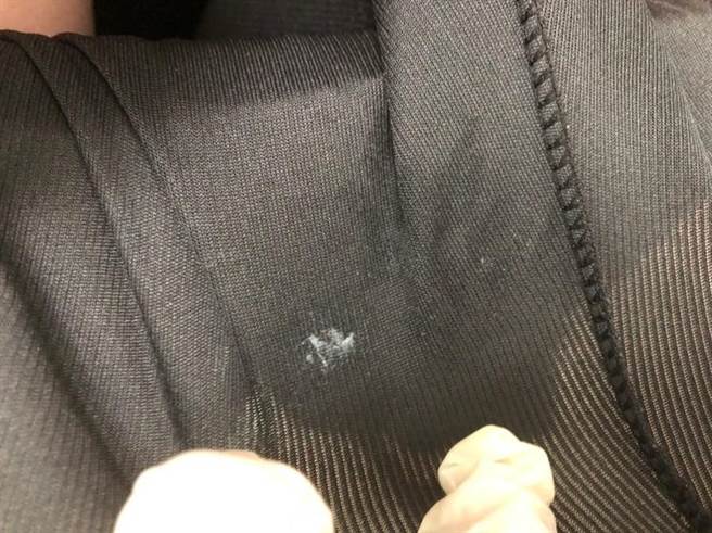 青少年对性好奇，约炮床战尝禁果，却不注意安全性行为的防护，导致经由体液接触感染淋病，下体化脓发炎，滴落的黄绿色分泌物沾染到内裤。（陈昭安医师提供／谢琼云彰化传真）