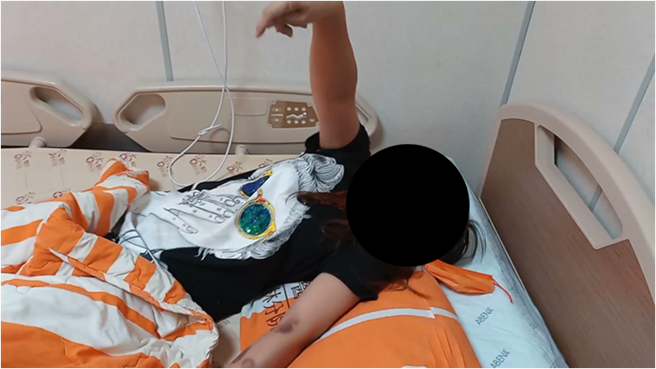 癫痫患者的表现方式不同，有些是抽搐型，有些是安静型，需要专业评估。（臺大云林分院提供）