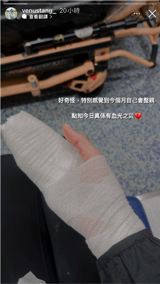 邓美欣发布IG限时动态，泪诉维护爱犬却遭咬伤。(图／邓美欣 IG)