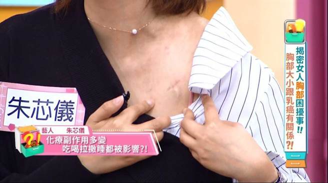 朱芯仪曝光人工血管的位置。（东森提供）