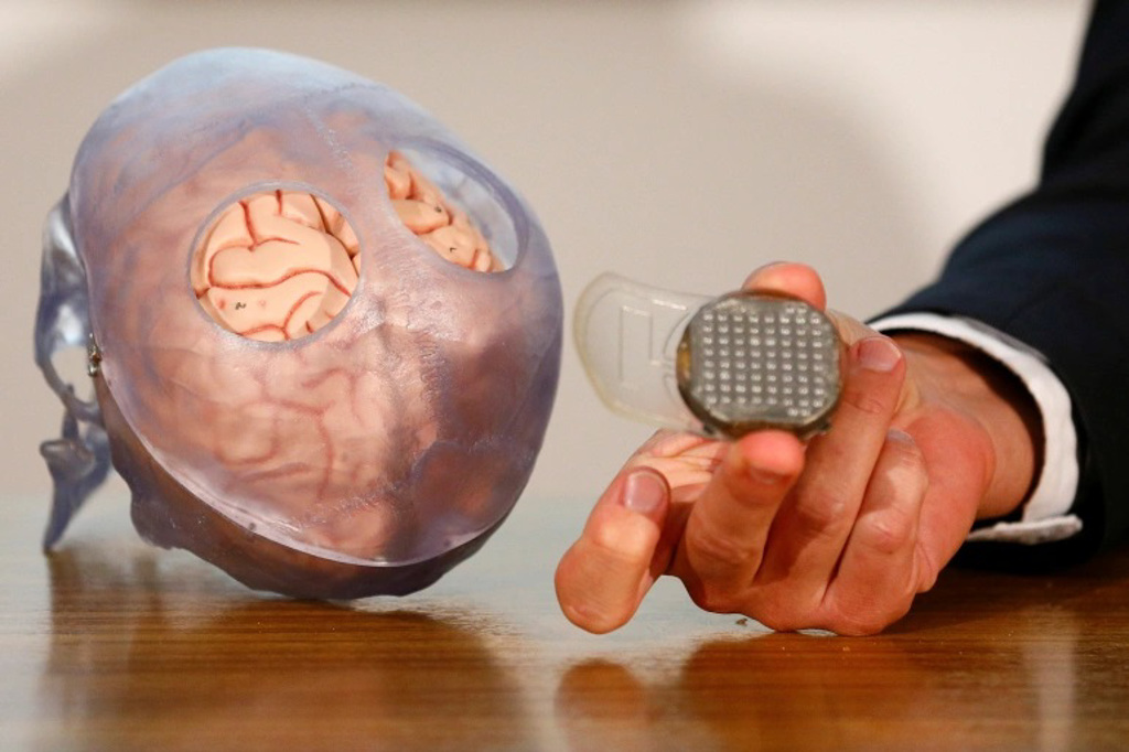研究人员表示植入晶片的大概位置，左右脑各一个。图/路透社(photo:ChinaTimes)