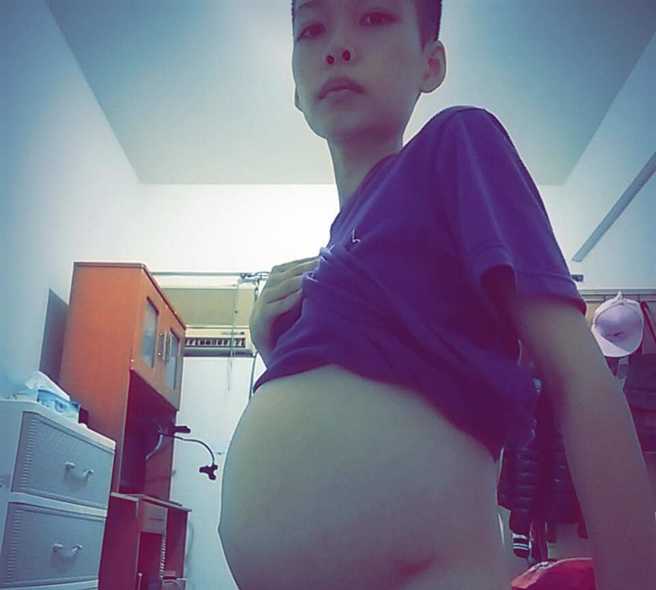 恶性腹水让她的肚子胀到和足月的孕妇一样大 (图/汤佩姿提供)