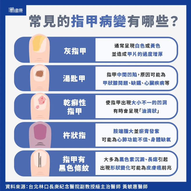 (圖/潮健康提供)