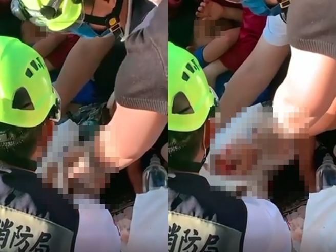 5歲弟弟當場被撞卡在電線桿與車子中間，右腿開放性骨折直冒鮮血，當下有對情侶目擊事故，趕緊幫忙救援，男童父母後來也趕到。（翻攝自Dcard）