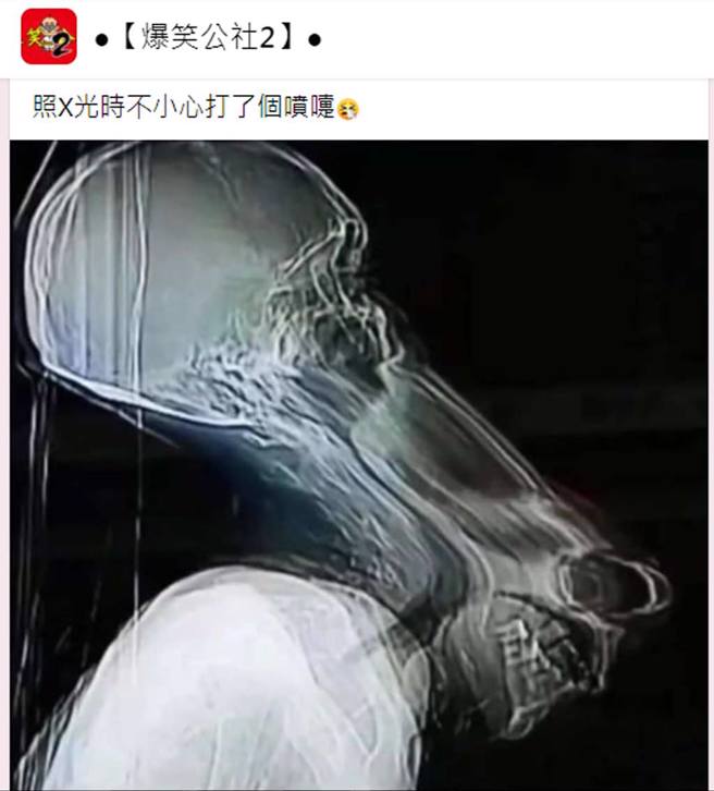 网友分享照片并注解：「照X光时不小心打了个喷嚏」，让眾多网友笑翻。（截自脸书《●【爆笑公社2】●》）
