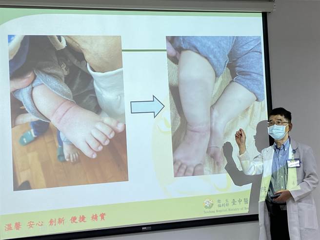 卫福部台中医院小儿科主任陈敏恭表示，因小孩皮肤平常就会分泌角质层脂质，如果过度使用保溼乳液反而会抑制它自然的分泌。（卢金足摄）