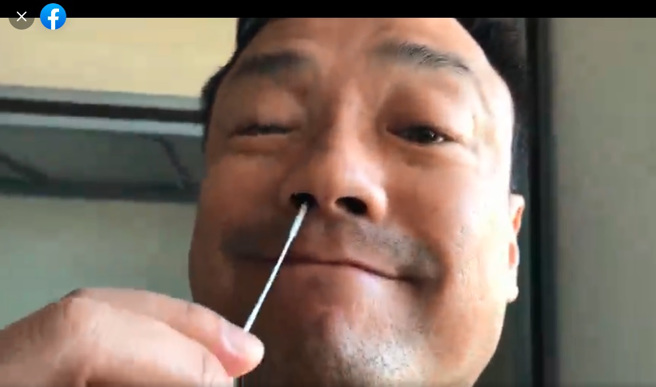 王喜做PCR被流血。(图／翻摄自王喜脸书)