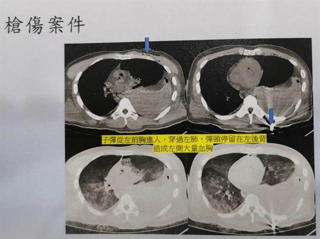 减少不必要解剖，法医研究所全面建置虚拟解剖。(蒋永佑翻摄)