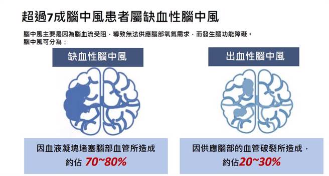 中風分類。(資料來源/國健署、台灣腦中風學會)