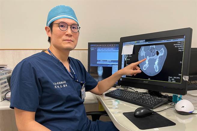 中医大新竹附医耳鼻喉科医医师陈俊志指出，40岁小张确诊罹患罕见的「鼻窦异生齿」。（罗浚滨摄）