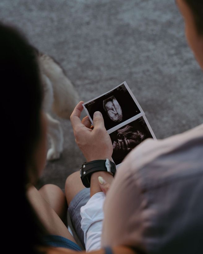 「卡卡」胡尹霏甜秀超音波照宣布怀孕。（图／取自卡卡IG）