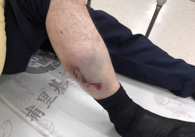 北山所所长陈志成右小腿红肿及擦挫伤、警员张元薰右手臂擦挫伤，两人均送埔里荣民医院急诊室治疗后，已返回驻地休息。（警方提供／吴建辉南投传真）