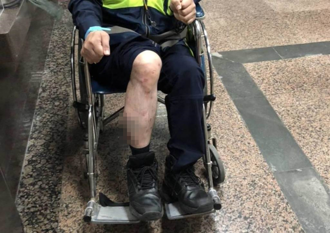 北山所所长陈志成右小腿红肿及擦挫伤、警员张元薰右手臂擦挫伤，两人均送埔里荣民医院急诊室治疗后，已返回驻地休息。（警方提供／吴建辉南投传真）