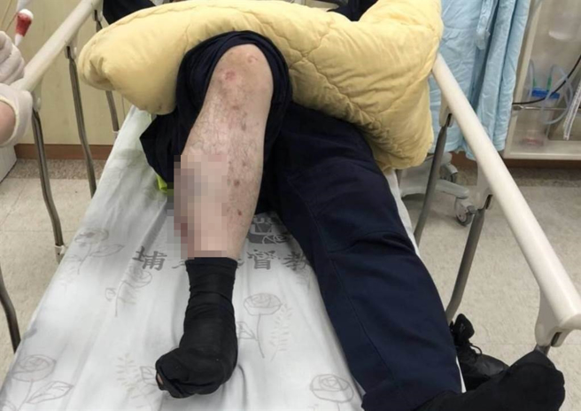 北山所所长陈志成右小腿红肿及擦挫伤、警员张元薰右手臂擦挫伤，两人均送埔里荣民医院急诊室治疗后，已返回驻地休息。（警方提供／吴建辉南投传真）