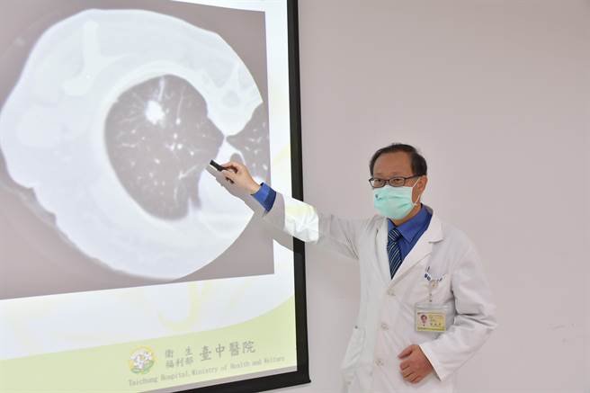 台中医院胸腔内科医师钟威升表示，每年新增肺癌人数约1万5000人，男女比约52％：48％。（台中医院提供／卢金足台中传真）