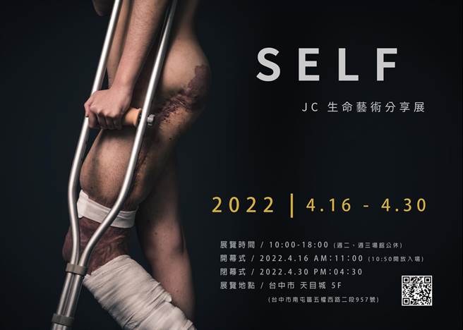 26岁的淇淇罹患先天性罕见疾病，血管淋巴瘤导致她左侧下肢病变、长期疼痛，须不断进出医院手术，充满疤痕，近日她成功在群眾募资平台募得赞助经费，举办展览、讲座，将自己的罕病生命故事歷程与大眾分享。（摘自脸书／谢琼云台中传真）