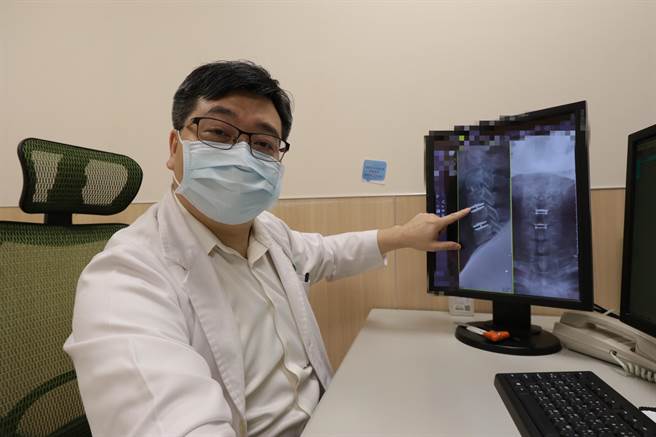 亚洲大学附属医院神经创伤科主任李建裕表示，颈髓病变经手术治疗后顺利解决神经压迫问题，也能维持住颈部活动角度。（亚洲大学附属医院提供／卢金足台中传真）