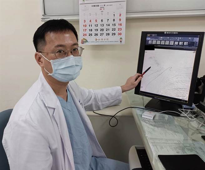 童醫院放射介入治療科主任李政君，筆指處即為發炎組織新生成異常的微小血管。（梧棲童醫院提供）
