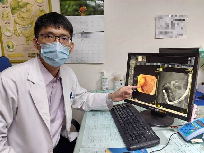 大千醫院醫師林德福表示，曾接受胃切除手術的病人容易發生膽結石，須特別留意。（大千醫院提供／謝明俊苗栗傳真）