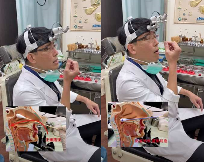 戳鼻子第一步先找到鼻孔地板，再斜着放入棉花棒，回正后贴着鼻孔地板前进到最深处转一转。(翻摄自 重庆耳鼻喉科诊所YouTube)