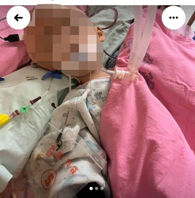 易姓男嬰疑遭保母施虐，目前昏迷命危。（摘自豐原社群臉書）