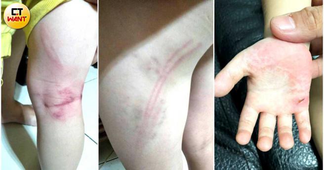 儿虐常见肢体暴力的伤害，包含推挤、碰撞、呼巴掌、拳头揍打等，造成孩子身心灵难以抹灭的阴影。（图／读者提供）