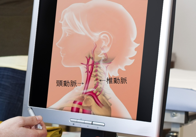 颈部动脉分布。（示意图／Shutterstock)