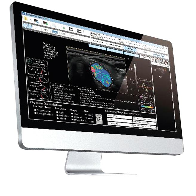 安克生医研发上市的甲状腺超音波AI辅助侦测智慧医材「安克甲状侦」。图／安克生医提供