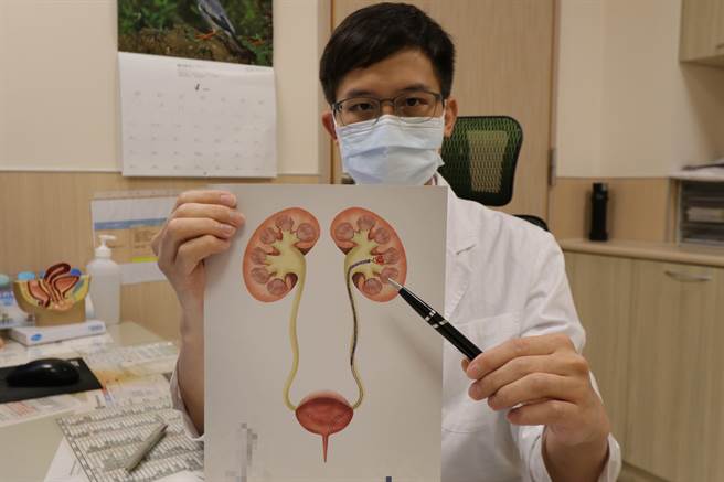 台中市一名中年妇女轻忽无痛性血尿，经医师以软式输尿管镜查出肿瘤上身。（亚大医院提供／卢金足台中传真）