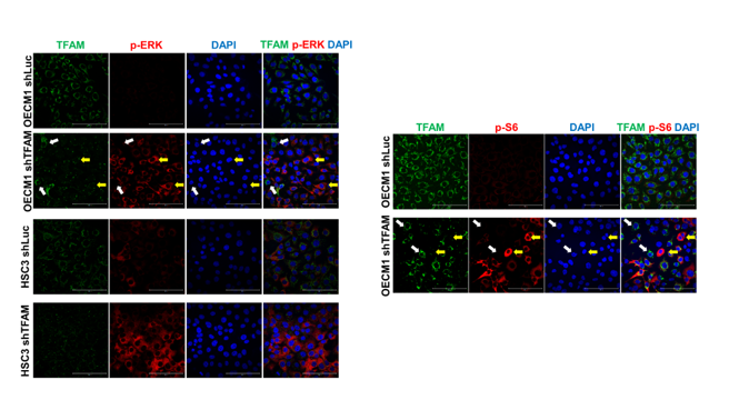 免疫萤光分析显示粒线体转录因子(TFAM)大量表现，可抑制头颈癌细胞传递路径。(图/阳明交大提供)