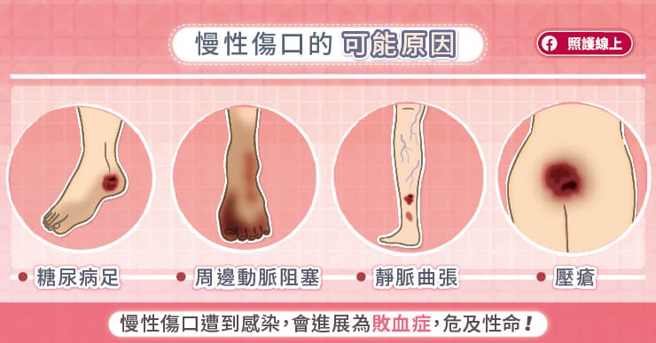 (图/照护线上提供)