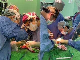 小港醫院首例口腔癌重建 8月孕醫跨團隊接力開刀
