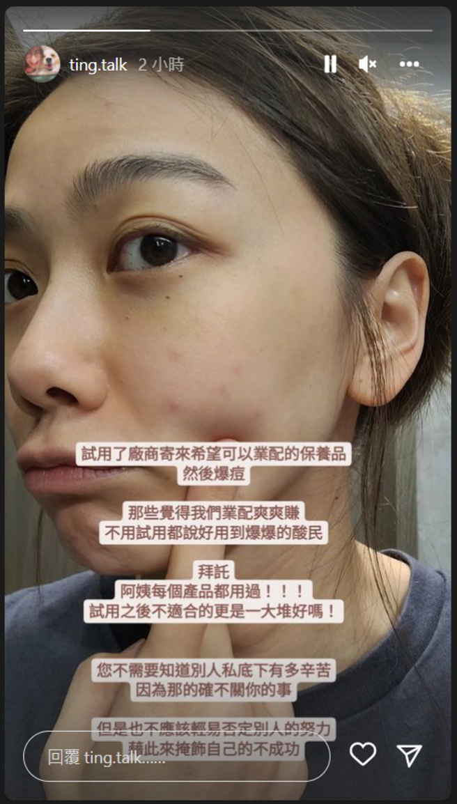 最近邵庭却遭到网友质疑，业配商品没使用就推荐，让她怒晒脸上有烂痘照反击。(图/ 摘自邵庭IG)