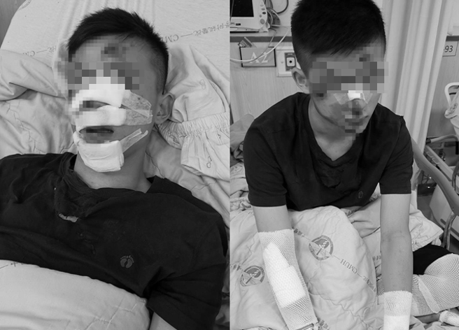 有少年行经台中市台湾大道辗到大坑洞摔落地，导致「嗅觉永久丧失」获国赔133万。（翻摄自爆料公社）