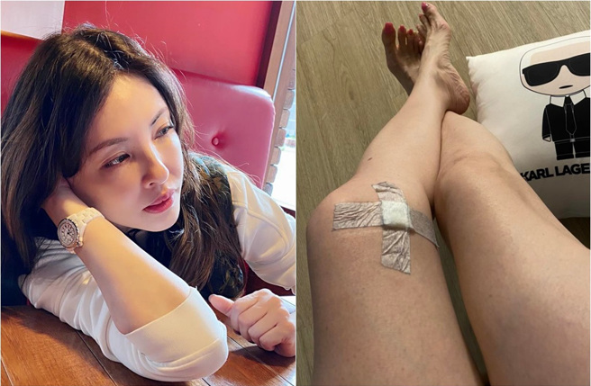 何如芸出完外景回家竟不能蹲，就医后发现韧带早已受伤，医生更表示是怀孕时负重，膝盖承受极大压力所致。(取材自何如芸 Michelle Ho脸书)