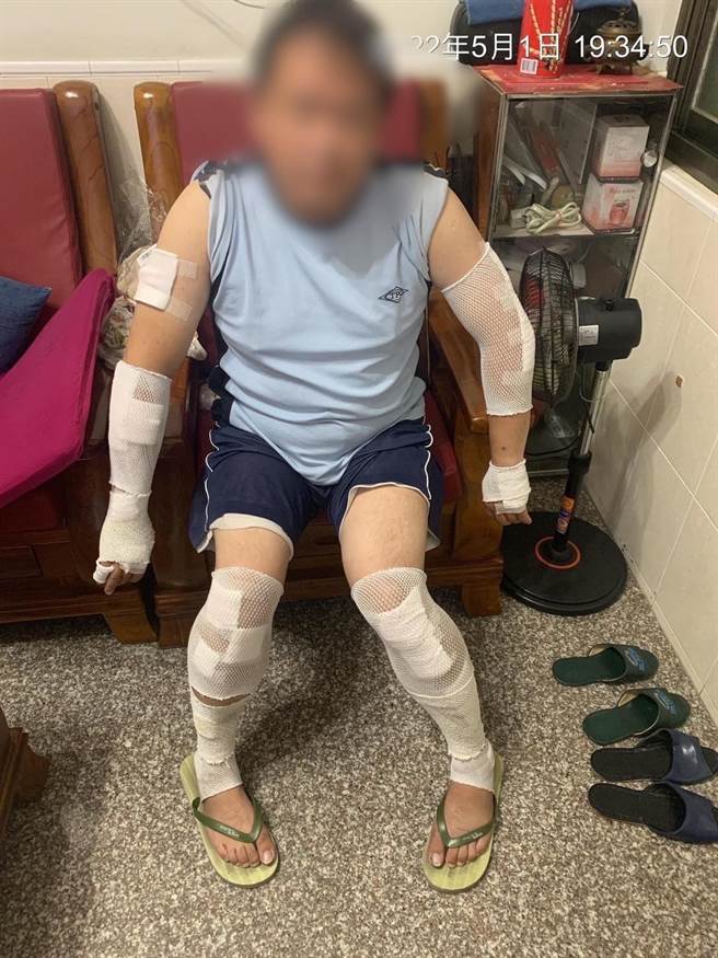 史姓司机的儿子竟从地磅站等候，伺机尾随2名巡逻员警，至冈山北路即高速衝撞庄姓员警，致庄姓员警全身四肢多处擦挫伤。(警方提供／林雅惠高雄传真)